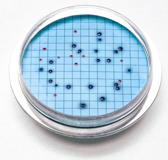 Membrane Filtration Media - Agar